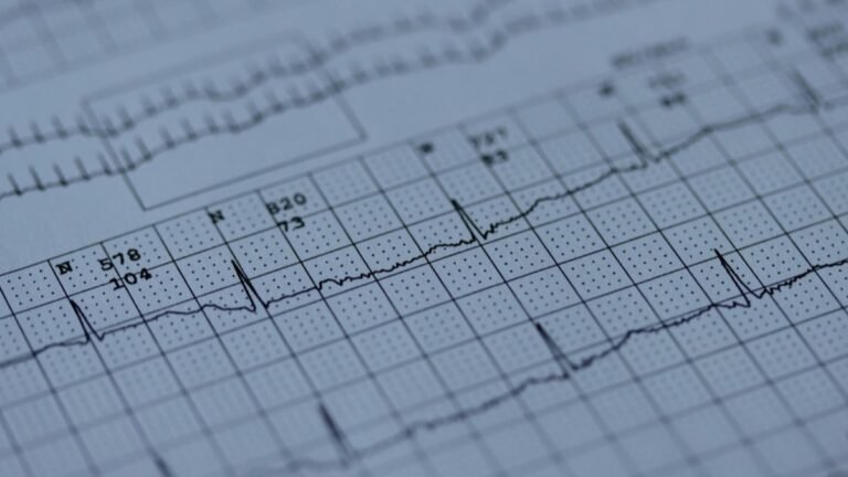 Electrocardiogram tracing on graph paper