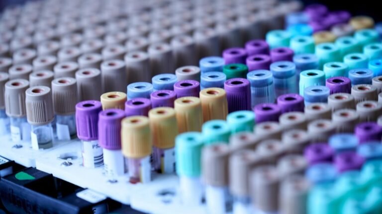 Color-coded blood collection tubes in a laboratory rack